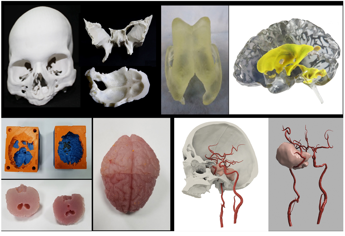 3D Printed Anatomical Models